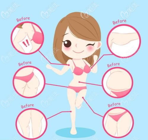 360環(huán)吸適合的部位 360環(huán)吸適合的部位