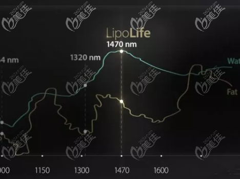 1470NM波長(zhǎng)