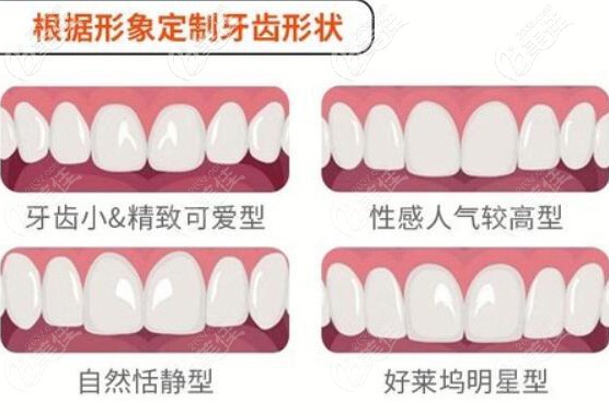 程紅梅擅于根據(jù)形象定制牙齒形狀 程紅梅擅于根據(jù)形象定制牙齒形狀