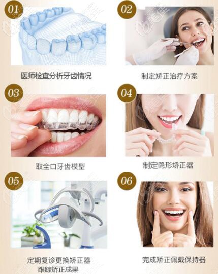 合肥壹加壹牙齒矯正全流程 合肥壹加壹牙齒矯正全流程