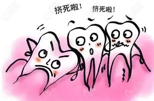 牙齒矯正為什么要拔牙 牙齒矯正為什么要拔牙