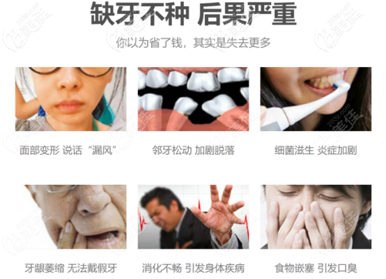 劉方明醫(yī)生告訴你缺牙不種的后果 劉方明醫(yī)生告訴你缺牙不種的后果