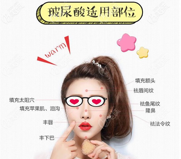 玻尿酸可以填充哪些部位