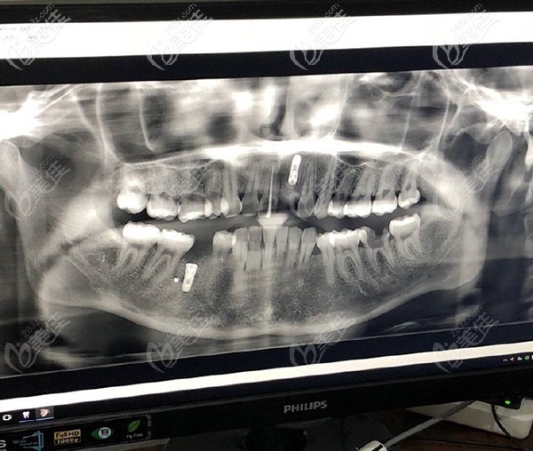 在濟(jì)南美奧拍CT 在濟(jì)南美奧拍CT