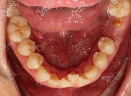 20201012_1602497002554813.png image.png