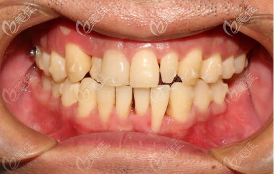 20201012_1602497019378520.png image.png