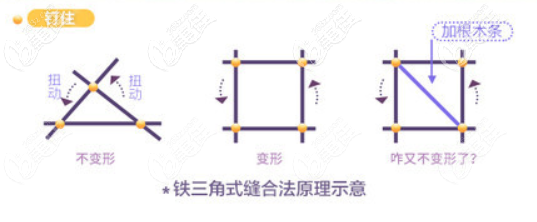 鐵三角縫合法圖示 鐵三角縫合法圖示