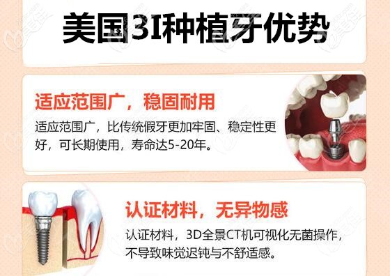 美國3i種植牙優(yōu)勢 美國3i種植牙優(yōu)勢