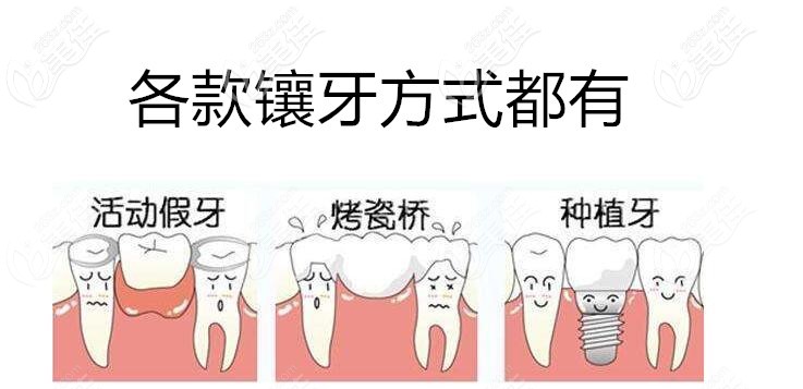 沈陽歡樂口腔各種鑲牙方式都有