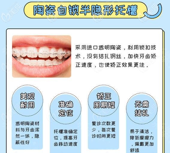 梅州中大口腔半隱形陶瓷自鎖托槽
