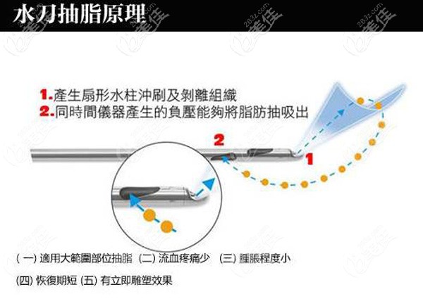 美貝爾用水動(dòng)力做大腿吸脂術(shù)
