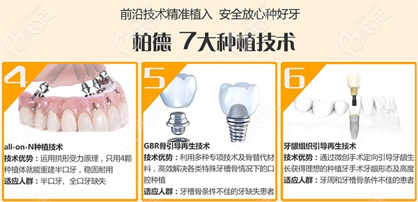 柏德口腔7大種植技術(shù)