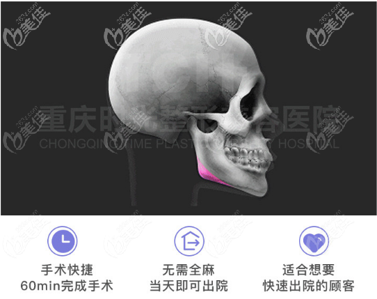 重慶時光姜民范磨骨特色 重慶時光姜民范磨骨特色