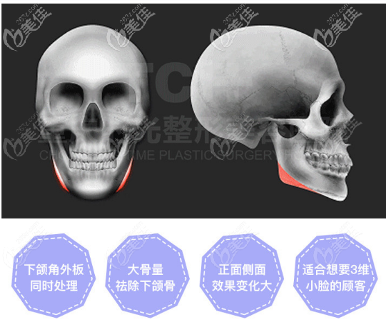 重慶時光姜民范磨骨優(yōu)勢 重慶時光姜民范磨骨優(yōu)勢