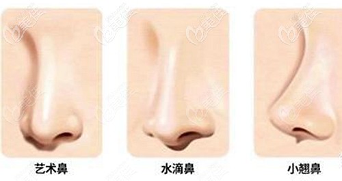 劉亞峰醫(yī)生擅長的隆鼻風格 劉亞峰醫(yī)生擅長的隆鼻風格