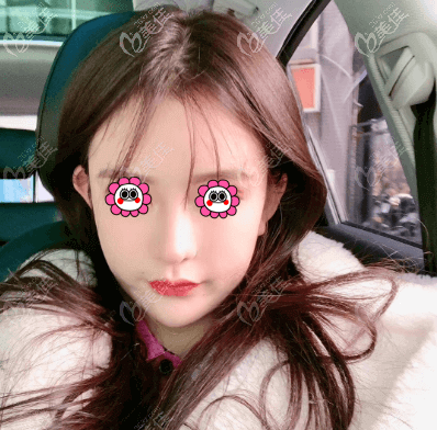 術(shù)后馬上3個(gè)月了