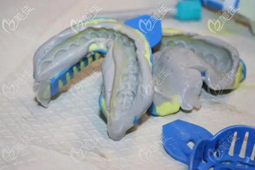 隱形矯正的復(fù)雜手術(shù)過(guò)程