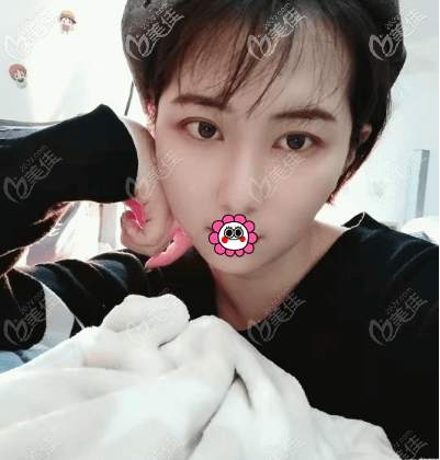 <!--<i data=20240703-sp></i>-->醫(yī)生給我做面部抽脂5個多月了 <!--<i data=20240703-sp></i>-->醫(yī)生給我做面部抽脂5個多月了