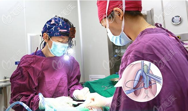 深圳富華高靜隆鼻怎么樣手術過程圖