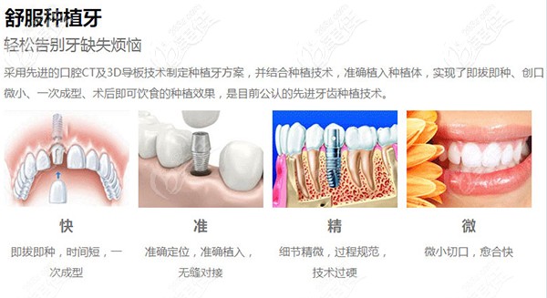 英式微創(chuàng)不痛種植牙 英式微創(chuàng)不痛種植牙