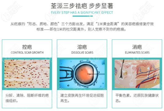 荃派三步祛疤術(shù)