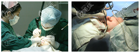 深圳博愛曙光白云醫(yī)生雙眼皮手術(shù)過程圖 深圳博愛曙光白云醫(yī)生雙眼皮手術(shù)過程圖