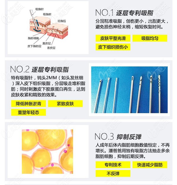 差點(diǎn)艾米麗面部吸脂優(yōu)勢