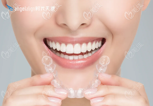 時(shí)代天使隱形矯正器 時(shí)代天使隱形矯正器