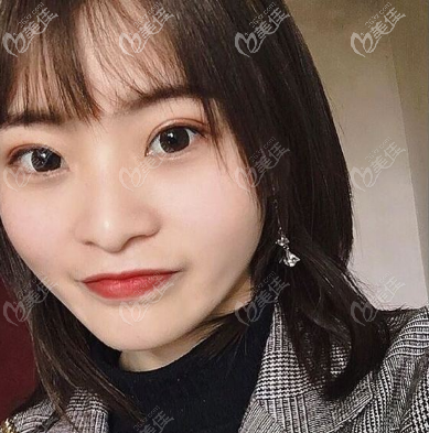 我之前在深圳博愛曙光做過手術(shù),白云醫(yī)生整形技術(shù)蠻好的