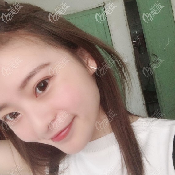 做完感覺深圳博愛曙光白云醫(yī)生技術(shù)很不錯(cuò) 做完感覺深圳博愛曙光白云醫(yī)生技術(shù)很不錯(cuò)