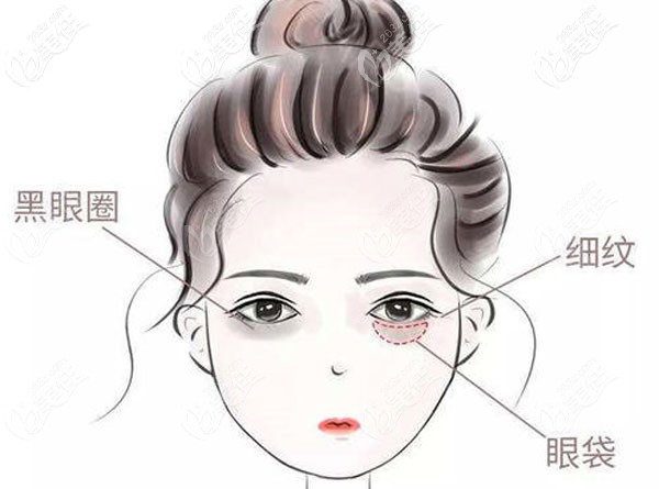 馮小良醫(yī)生眼部整形到底怎么樣呢 馮小良醫(yī)生眼部整形到底怎么樣呢