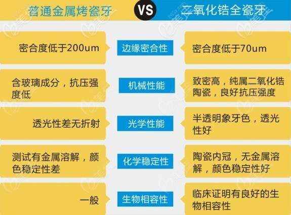 全瓷牙和烤瓷牙的區(qū)別 全瓷牙和烤瓷牙的區(qū)別