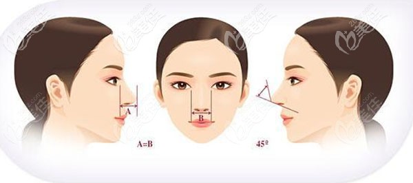 文杰醫(yī)生做鼻子的技術(shù)優(yōu)勢 文杰醫(yī)生做鼻子的技術(shù)優(yōu)勢