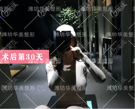 濰坊華美做隆胸的術后第30天狀態(tài) 濰坊華美做隆胸的術后第30天狀態(tài)