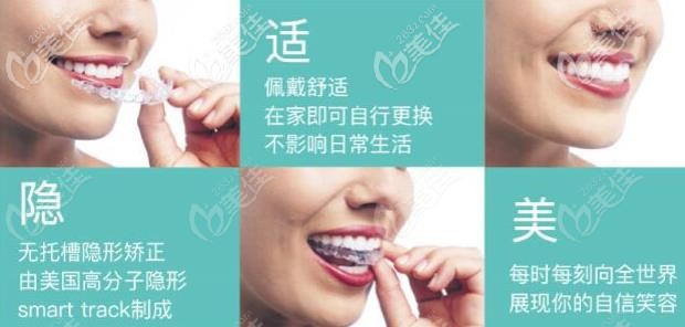 隱適美隱形牙套