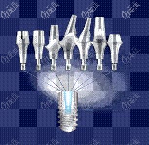 美國(guó)zimmer杰美種植體特點(diǎn)