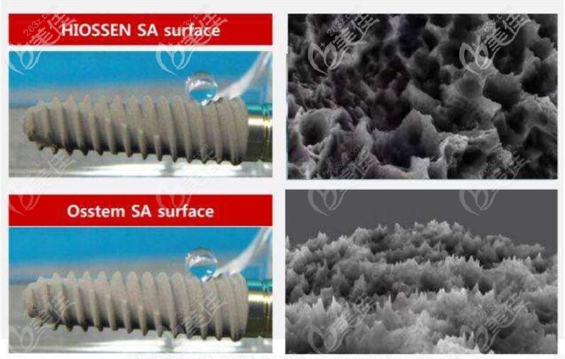 國(guó)皓圣hiossen種植系統(tǒng)特點(diǎn)