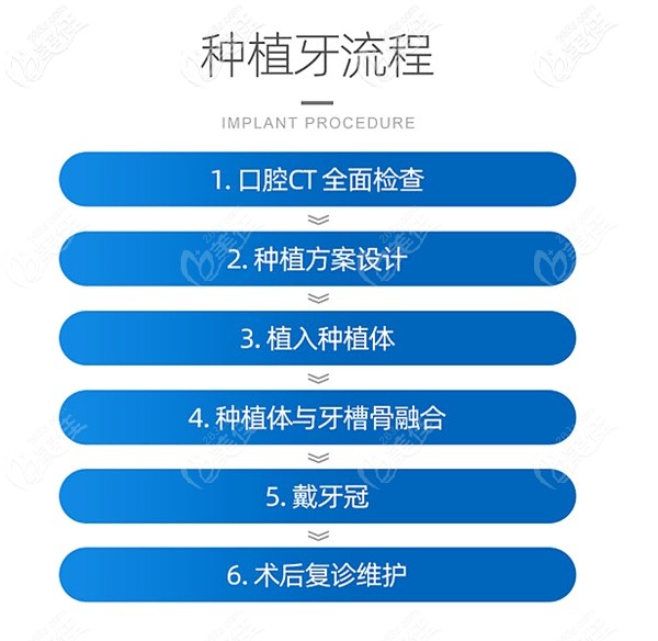 口腔種植牙的流程 口腔種植牙的流程