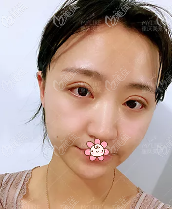 術(shù)后一周 術(shù)后一周