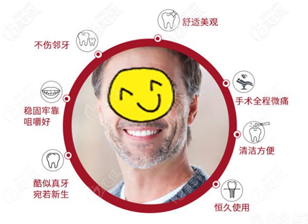 種植牙優(yōu)勢 種植牙優(yōu)勢
