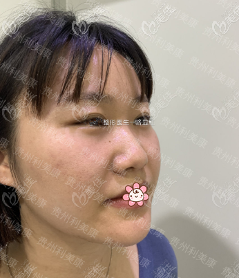 側(cè)面更塌 側(cè)面更塌