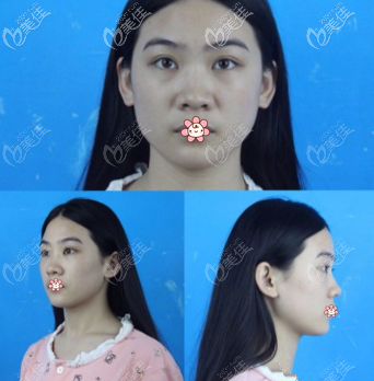 我原來的鼻子 我原來的鼻子