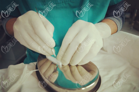 劉醫(yī)生在雕刻假體形狀 劉醫(yī)生在雕刻假體形狀