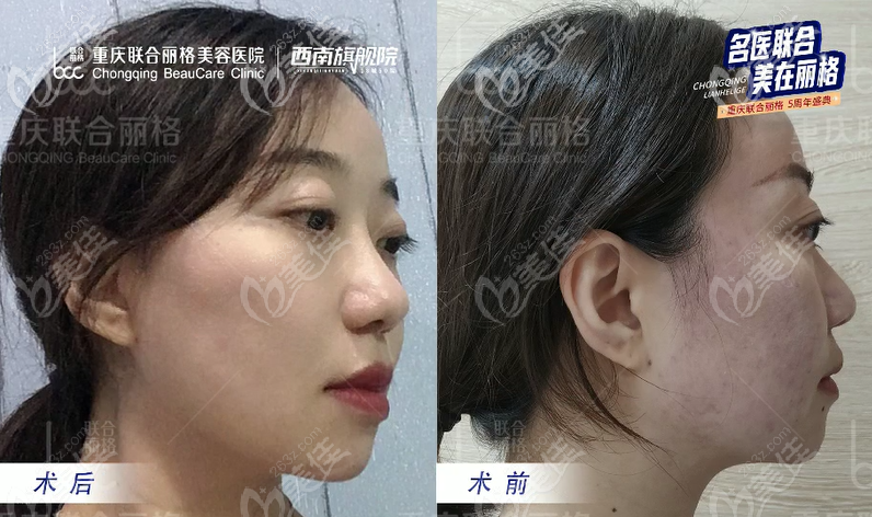 側(cè)面效果也很明顯