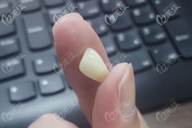 二氧化鋯全瓷牙