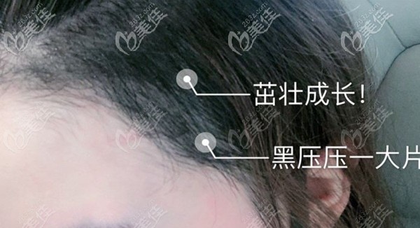 額角種植1800單位效果