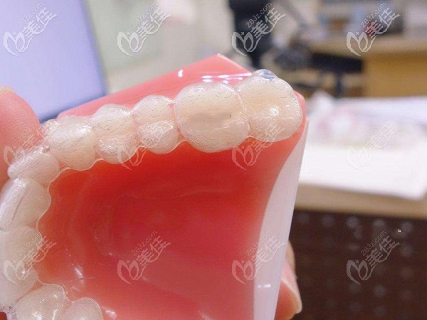 Invisalign隱適美牙套矯正 Invisalign隱適美牙套矯正