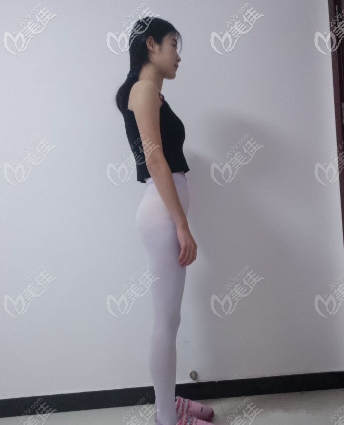 3個月后肚子小了很多