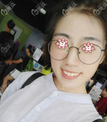 原來(lái)我有點(diǎn)兒齙牙 原來(lái)我有點(diǎn)兒齙牙