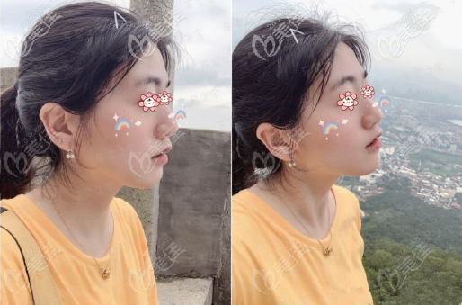 側(cè)面看牙也不齙了 側(cè)面看牙也不齙了